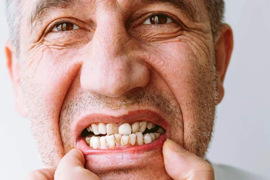 Jak odbudować uszkodzony ząb